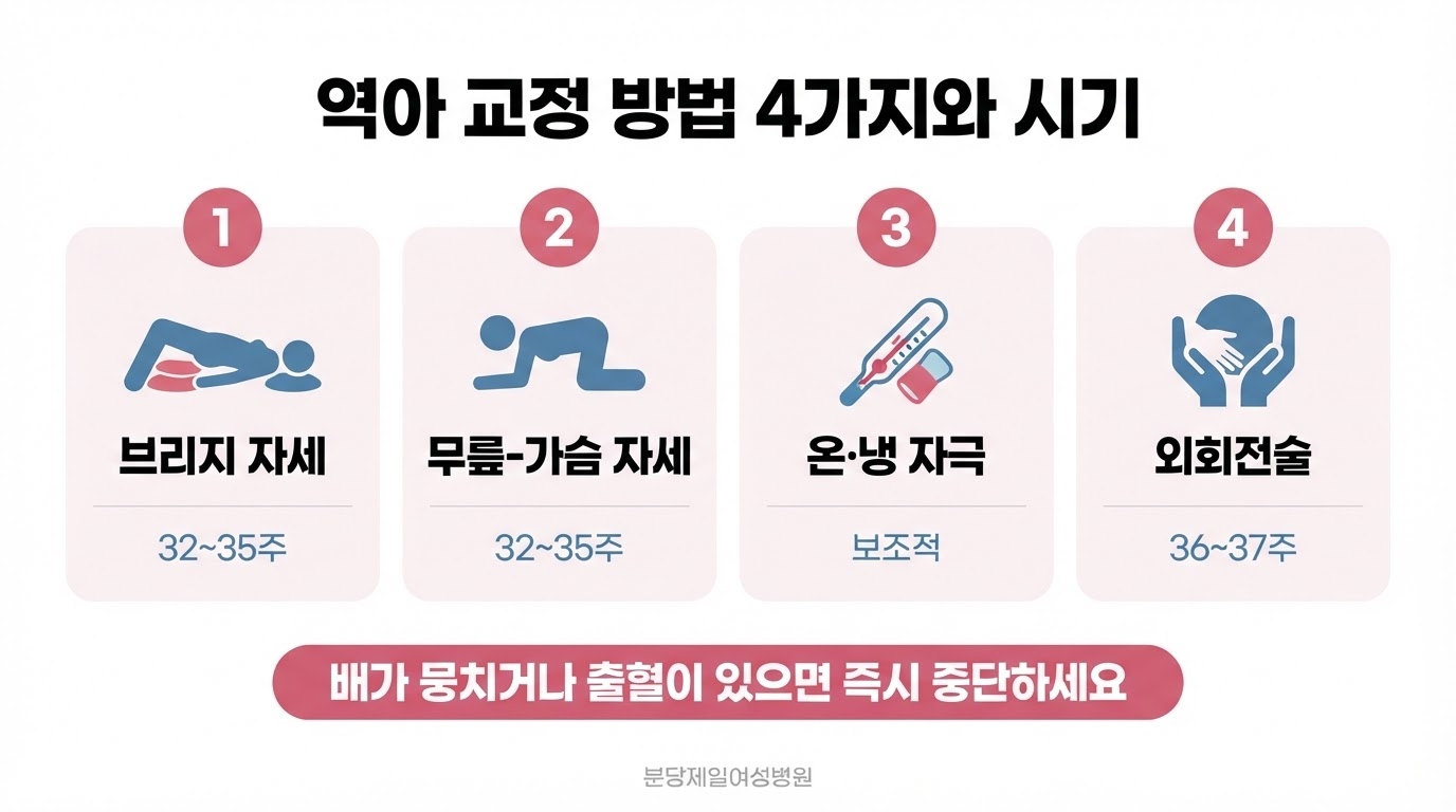 역아 교정 방법을 브리지 자세, 무릎-가슴 자세, 온·냉 자극, 외회전술 네 가지 번호 카드로 나누고 각 방법의 권장 주수와 중단해야 할 기준을 아래에 함께 표시한 한글 인포그래픽